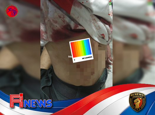 Mahasiswa Dibacok di Sudirman Padangsidimpuan, Empat Orang Diamankan Polisi